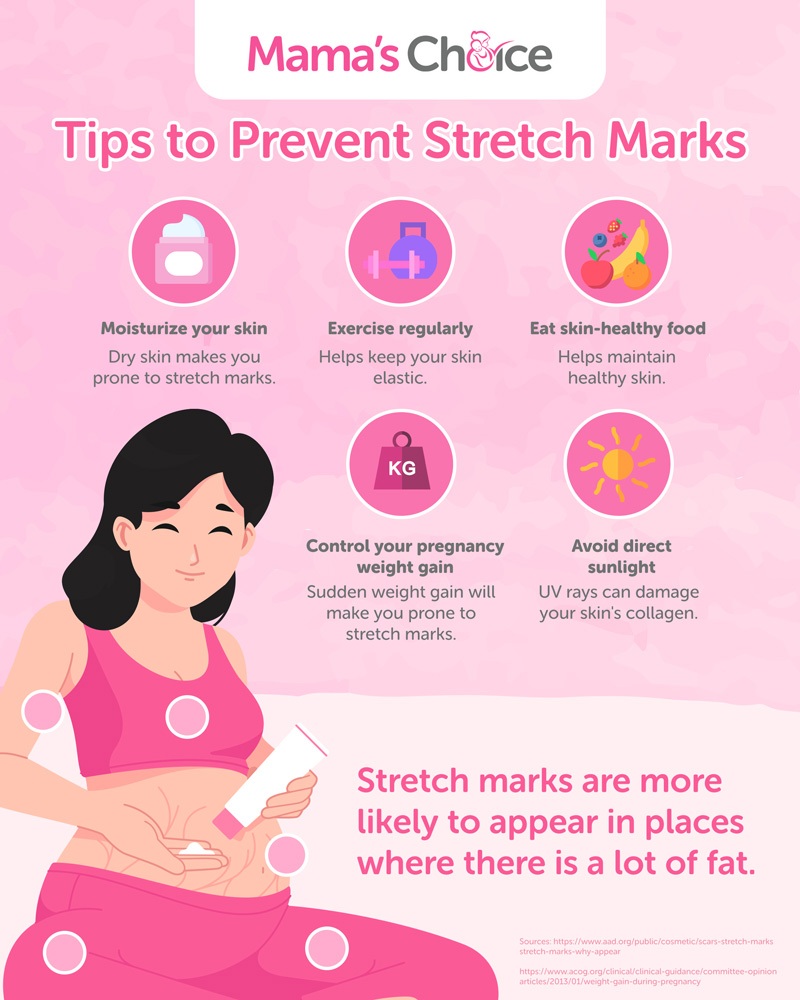 Tips to prevent stretch marks during pregnancy