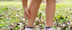 is deet insect repellent safe