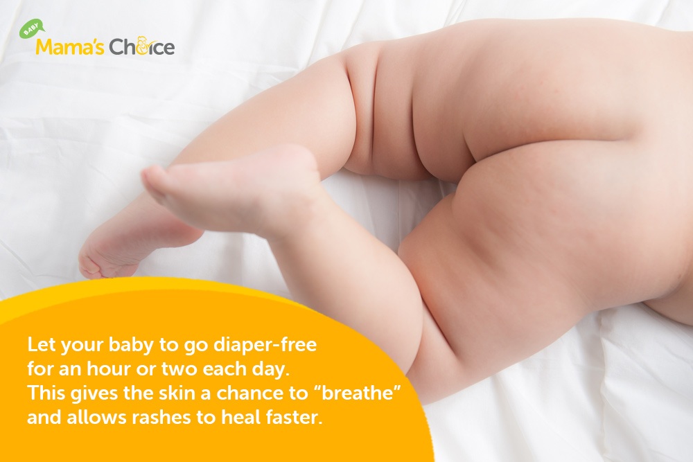 Tip to prevent diaper rash in babies
