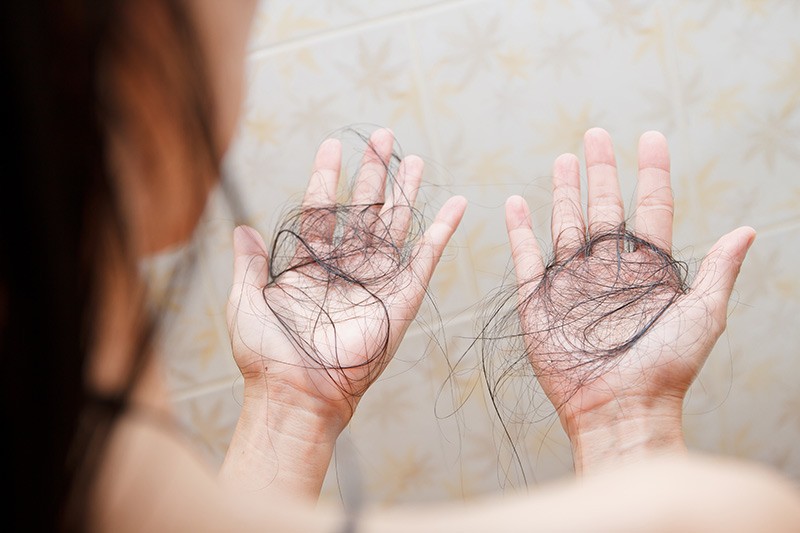 postpartum-hair-loss